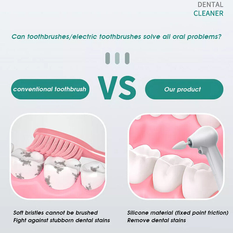 Tooth Polisher Electric Teeth Whitening Cleaning For Plaque Stain Removal Yellow